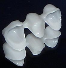  CS_Renishaw_Fig-2_zirconia-bridge-framework.jpg